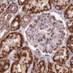 Anti-HSDL2 Antibody