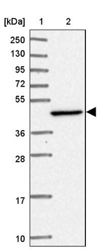 Anti-HSDL2 Antibody