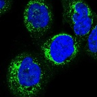 Anti-HSDL2 Antibody