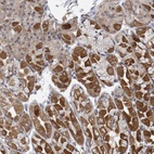 Anti-HIVEP1 Antibody