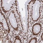 Anti-HNRNPL Antibody