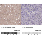 Anti-TLN2 Antibody