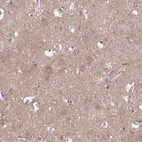 Anti-TLN2 Antibody