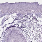 Anti-TRIM72 Antibody