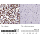 Anti-TXN Antibody