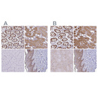 Anti-TXN Antibody