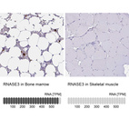 Anti-RNASE3 Antibody