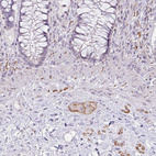 Anti-CDH19 Antibody