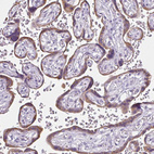 Anti-CDH19 Antibody