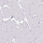 Anti-CDH19 Antibody