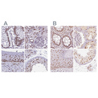 Anti-PPP1R10 Antibody