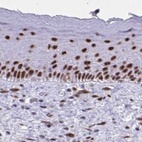 Anti-PPP1R10 Antibody