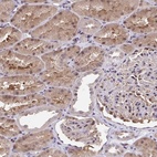 Anti-C5orf24 Antibody