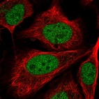 Anti-C5orf24 Antibody