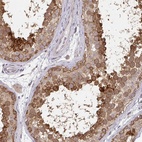 Anti-RANGRF Antibody