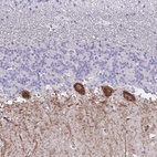 Anti-GALNT16 Antibody