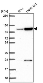 Anti-KIAA1614 Antibody