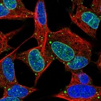 Immunofluorescent staining of human cell line SH-SY5Y shows localization to nuclear membrane & vesicles.