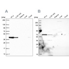 Anti-GIPC1 Antibody