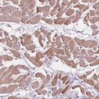 Anti-PLA2G2E Antibody