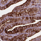 Anti-TM6SF2 Antibody