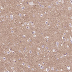 Anti-TM6SF2 Antibody