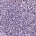 Anti-TM6SF2 Antibody