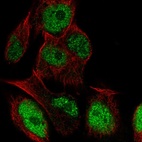 Anti-LRRC28 Antibody