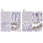 Anti-HIST1H1T Antibody