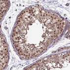 Immunohistochemical staining of human testis shows moderate to strong nuclear positivity in cells in seminiferous ducts.