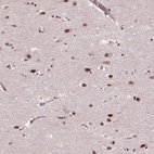 Anti-MED6 Antibody