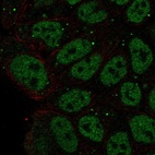 Anti-ZNF585B Antibody