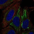 Anti-MT-ND4L Antibody