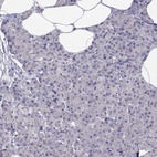 Anti-HSF2BP Antibody