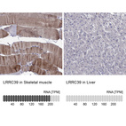 Anti-LRRC39 Antibody