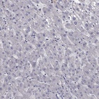 Immunohistochemical staining of human liver shows low expression as expected.