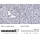 Anti-MC2R Antibody