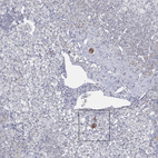 Anti-MC2R Antibody