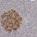 Anti-GCH1 Antibody