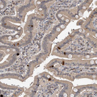 Anti-GCH1 Antibody