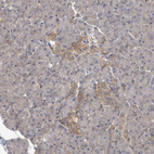 Anti-PGAM1 Antibody