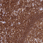 Anti-CORO1A Antibody