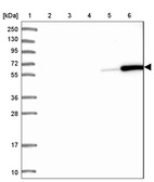 Anti-CORO1A Antibody