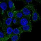 Anti-CORO1A Antibody