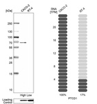 Western blot analysis in human cell lines Caco-2 and RT-4 using Anti-PTCD1 antibody. Corresponding PTCD1 RNA-seq data are presented for the same cell lines. Loading control: Anti-GAPDH.