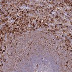 Anti-EFHD2 Antibody