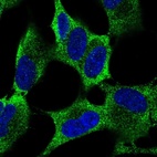 Immunofluorescent staining of human cell line SH-SY5Y shows localization to cytosol.