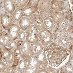 Immunohistochemical staining of human kidney shows moderate membranous-cytoplasmic positivity in cells in glomeruli and cells in tubules.