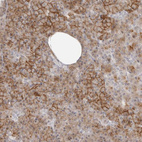 Immunohistochemical staining of human pancreas shows strong membranous-cytoplasmic positivity in exocrine glandular cells.