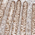 Immunohistochemical staining of human colon shows moderate membranous-cytoplasmic positivity in glandular cells.